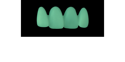 Cod.C20Facing : 15x  wax facings-bridges,  MEDIUM, Tapering ovoid, Overlapping,  TOOTH 12-22, compatible with Cod.A20Lingual,TOOTH 12-22 for long-term provisionals preparation